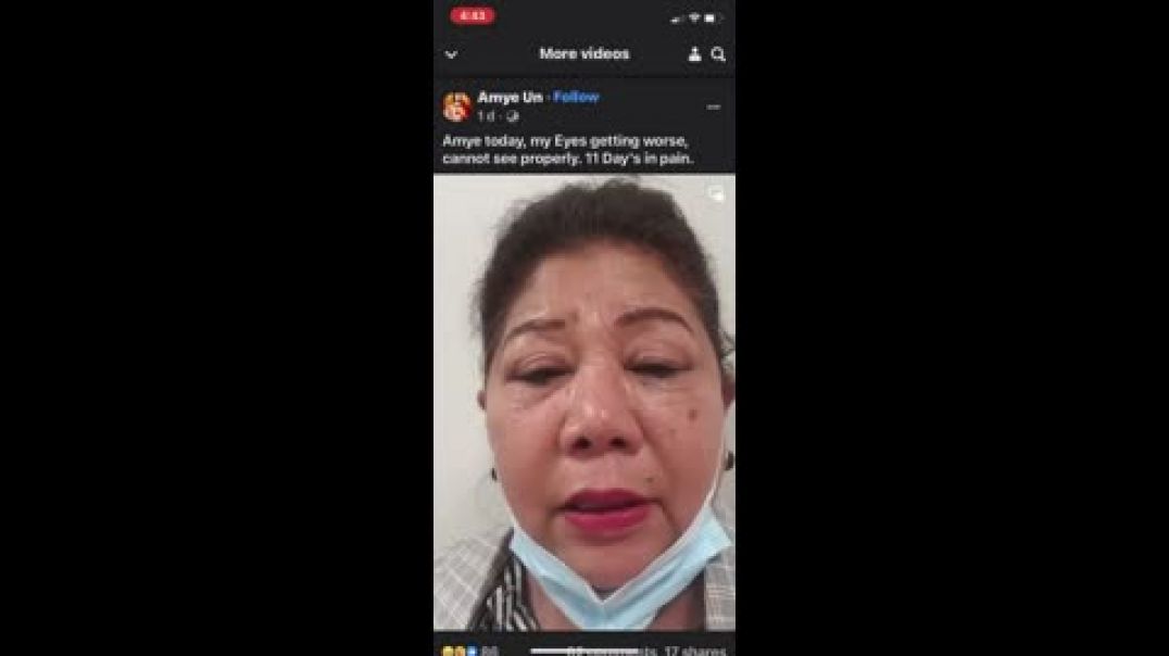 Азиатская женщина потеряла зрение после вакцинации